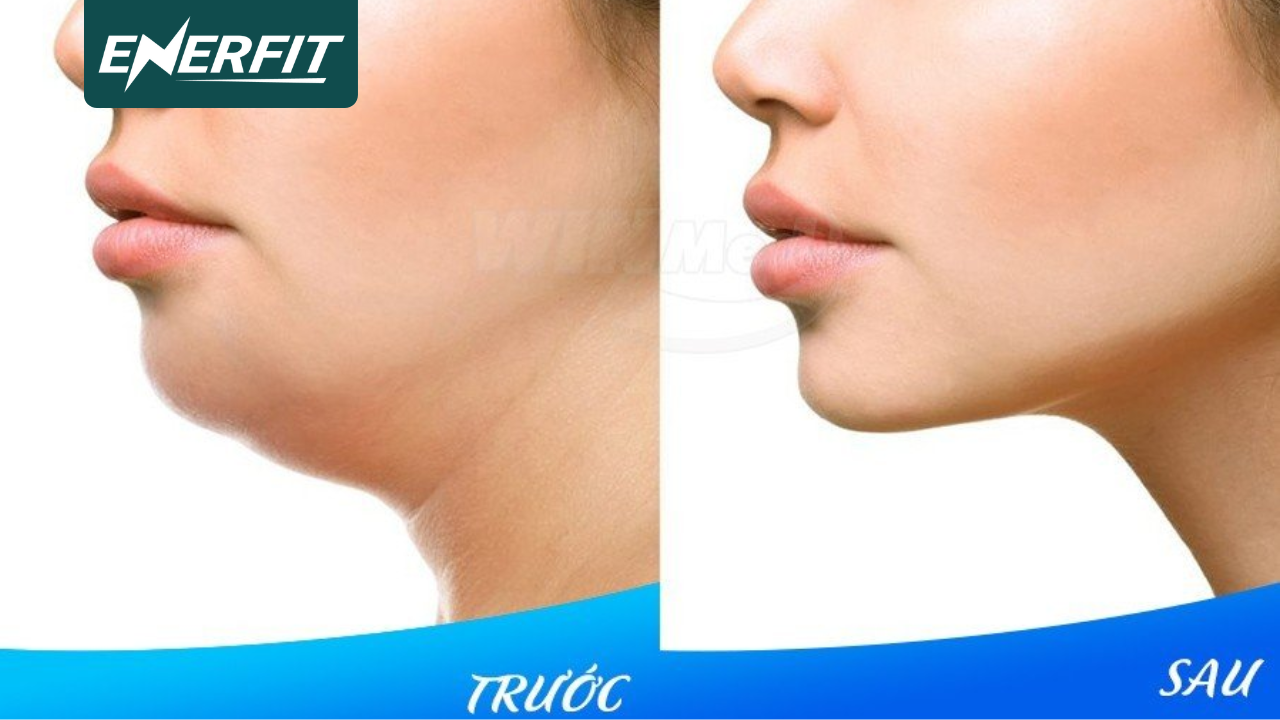 Nhảy dây có giảm mỡ mặt không 